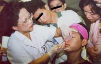 楊麗姝醫師教民眾如何清潔臉部粉刺